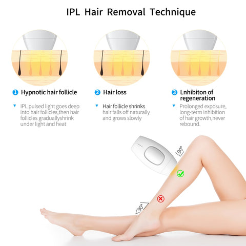 IPL Laser Hair Removal - stralskin